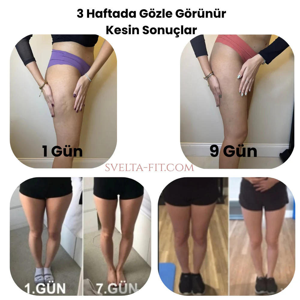 Svelta-Fit™ Bacak İncelten Sıkılaştıran Masaj Aleti